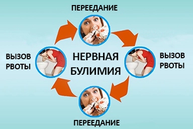 Лечение булимии в Кашине